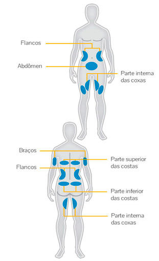 Coolsculpting | tratamento da gordura localizada